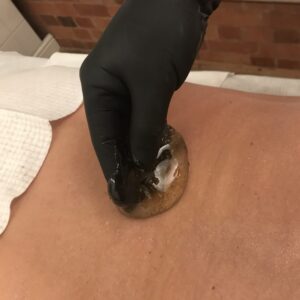 sugaring hair removal for men
